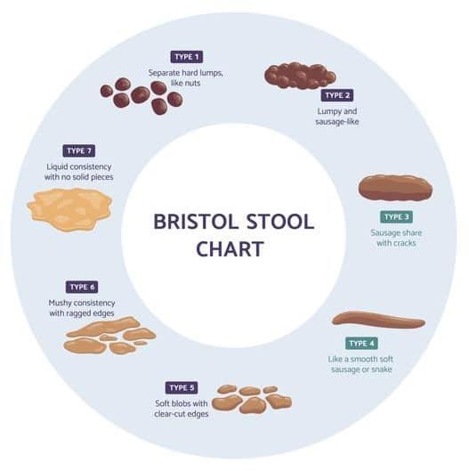 Bristol Stool Chart